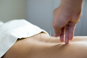 acupuncteur à Bourgoin-Jallieu