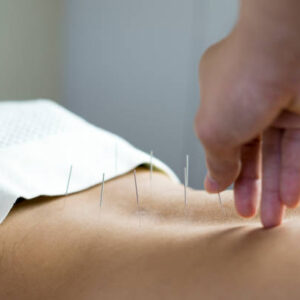 acupuncteur à Bourgoin-Jallieu