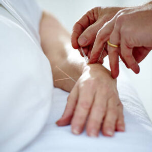 acupuncteur à Bourgoin-Jallieu