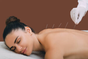 acupuncteur à Bourgoin-Jallieu