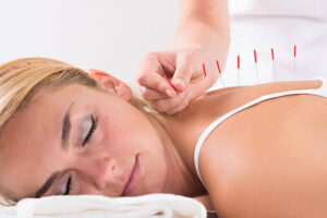 acupuncteur à Bourgoin-Jallieu